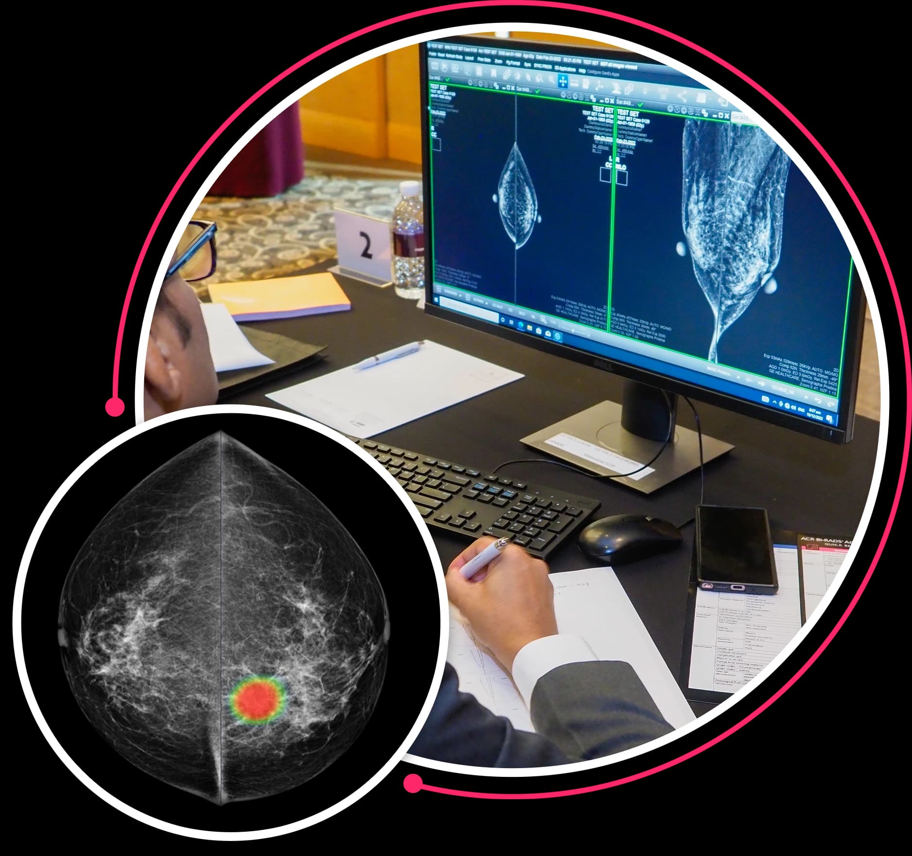 BIEDX Mammography Bootcamp with AI 2026