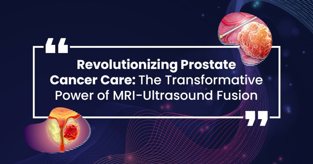 Power of MRI-Ultrasound Fusion