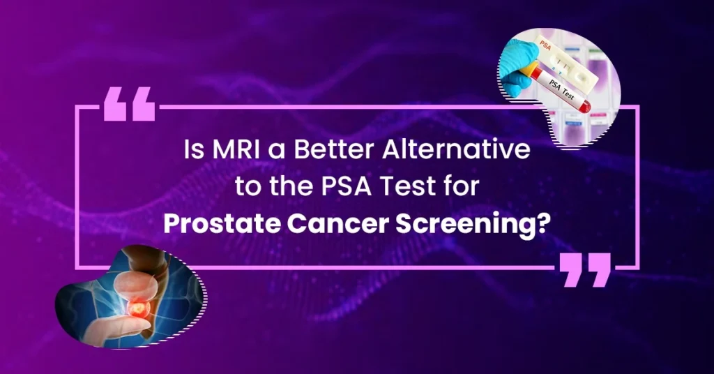 Is MRI a Better Alternative to the PSA Test for Prostate Cancer Screening?