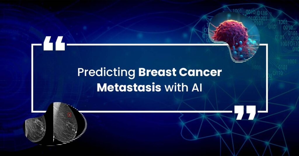 Predicting Breast Cancer Metastasis with AI